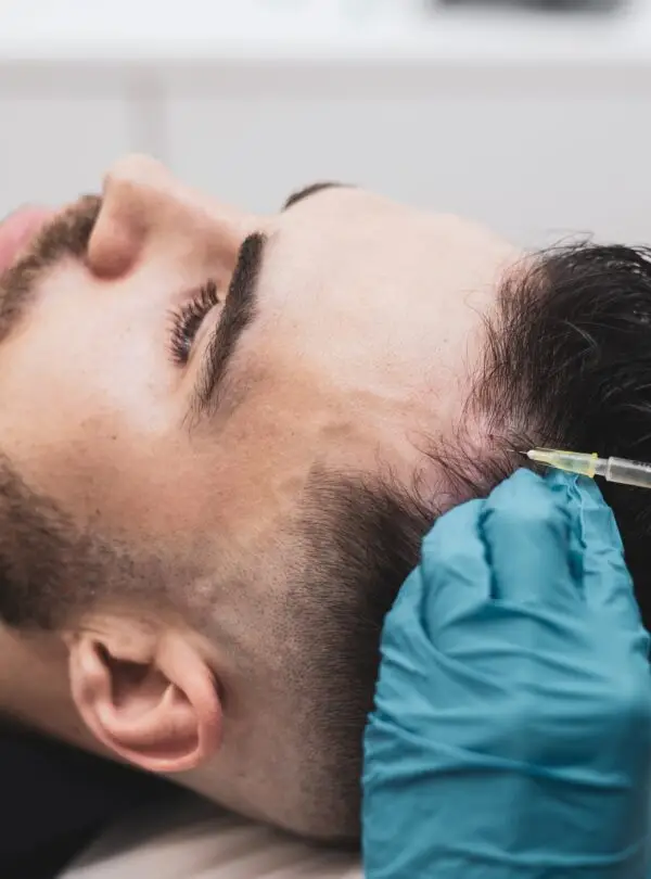 stem-cell-hair-implant-square