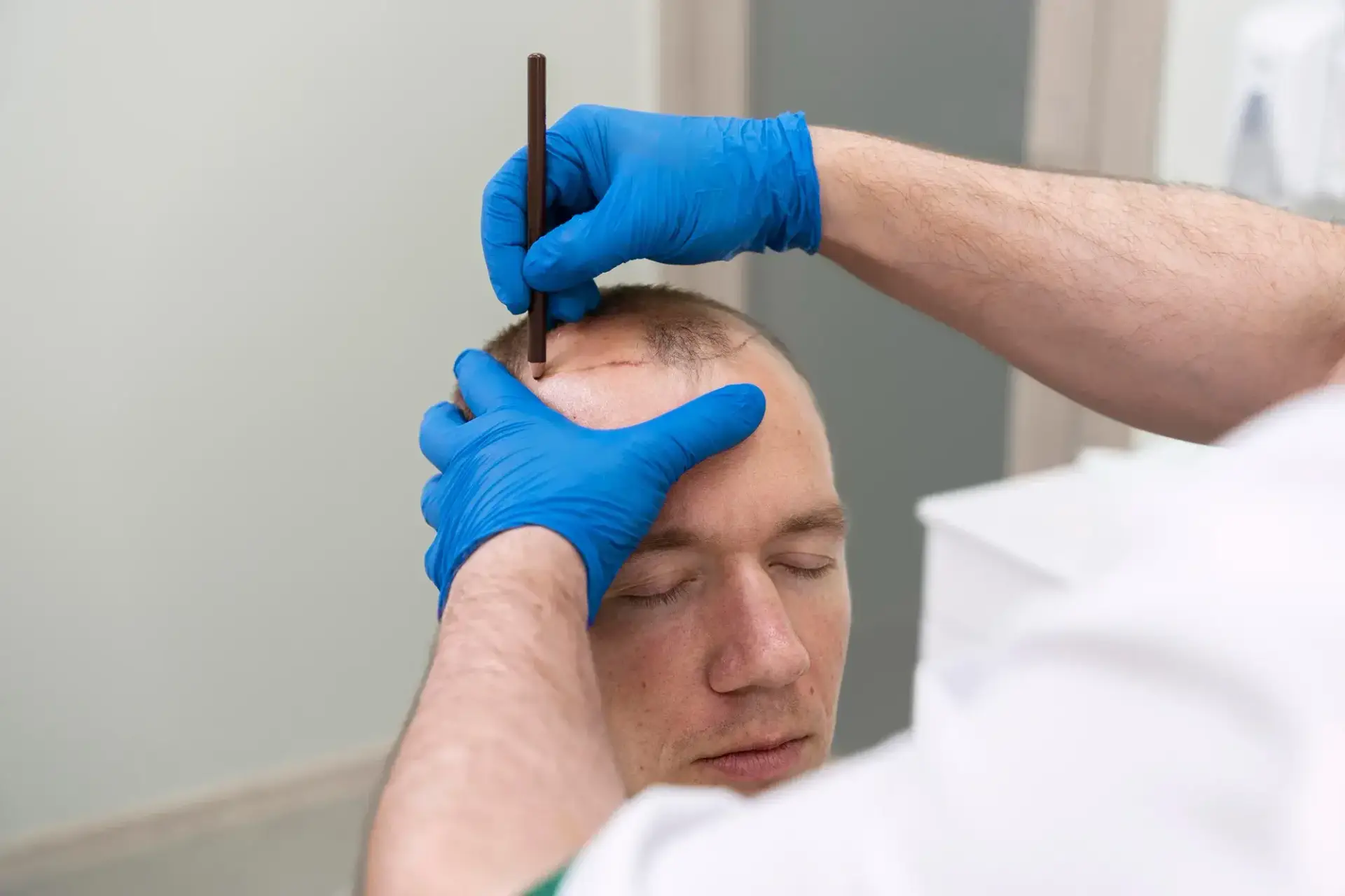 Cheapest Countries for Hair Transplant in the world